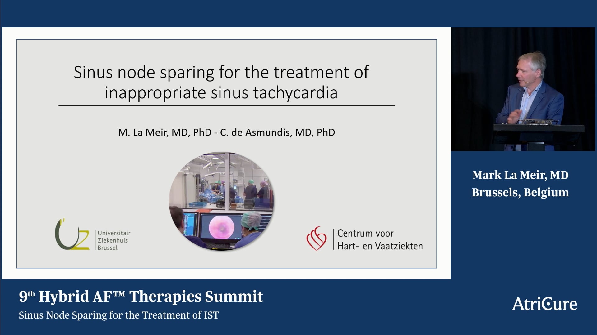 Sinus Node Sparing for the Treatment of IST